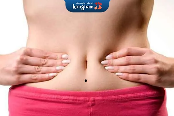 mụn ruồi ở dưới rốn nữ