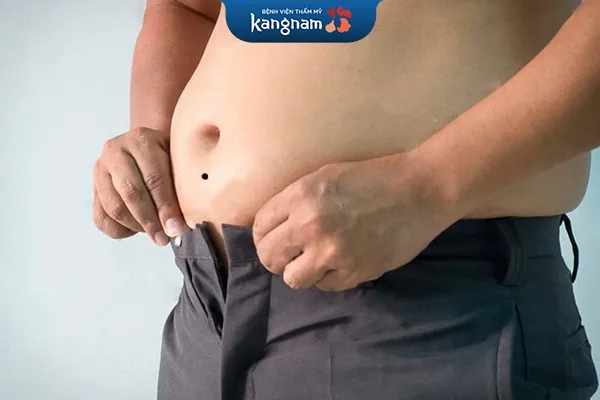 nốt ruồi phía dưới rốn 