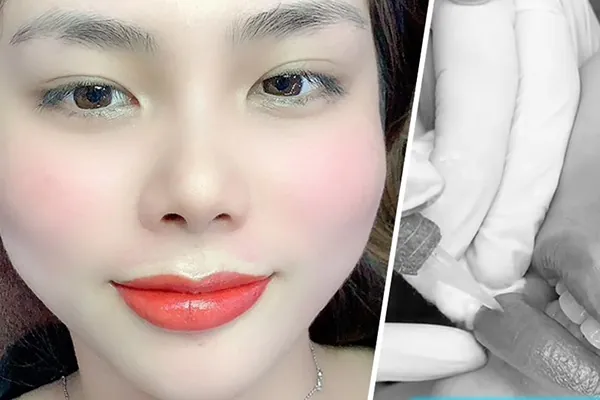 Sau sinh bao lâu thì được phun môi