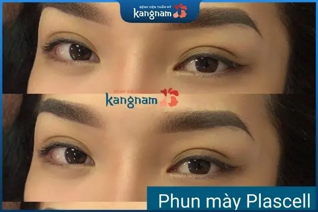 Quy trình phun mày Plascell