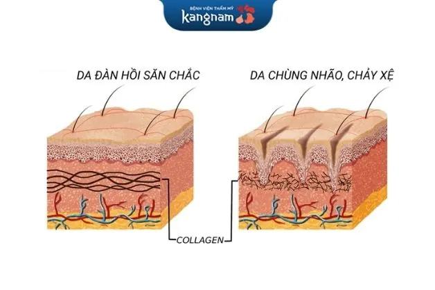 Collagen giúp da săn chắc