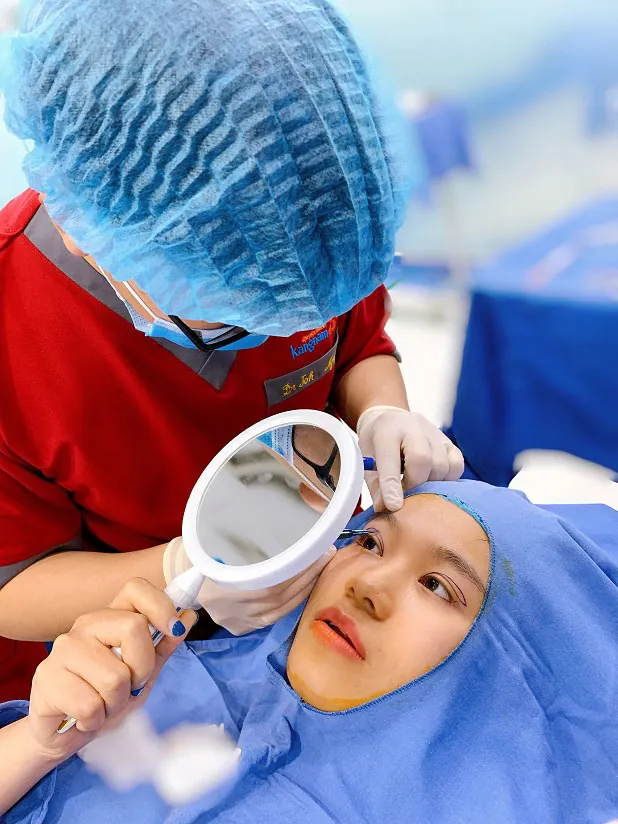 Bác sĩ thiết kế tỉ lệ mí, đo vẽ trước phẫu thuật