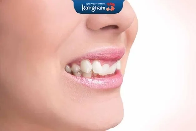 Lệch khớp cắn gây ra nhiều hệ lụy