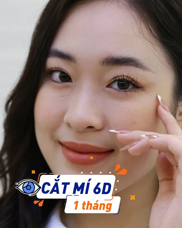Khách hàng cắt mí 6D 1 tháng 
