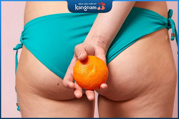 Nốt ruồi ở mông là người có tài, đạt được thành công trên nhiều phương diện