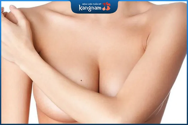 Nốt rười mọc ở ngực phụ nữ là có tướng phú quý