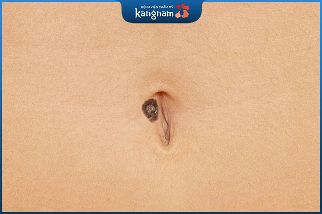 Những người sở hữu nốt ruồi ở rốn thường sống an nhàn