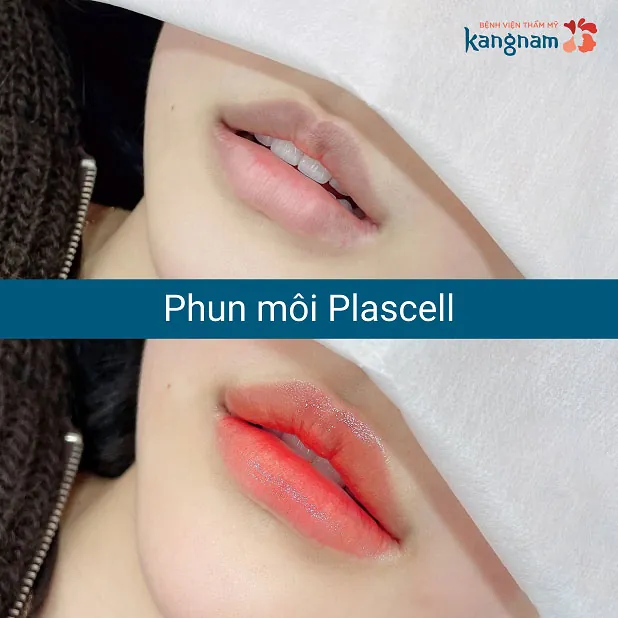 Bạn Mỹ Duyên (24 tuổi tại Quảng Ninh) khắc phục môi nhợt nhạt hiệu quả