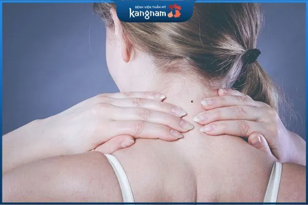 Vị trí nốt ruồi ở sau cổ