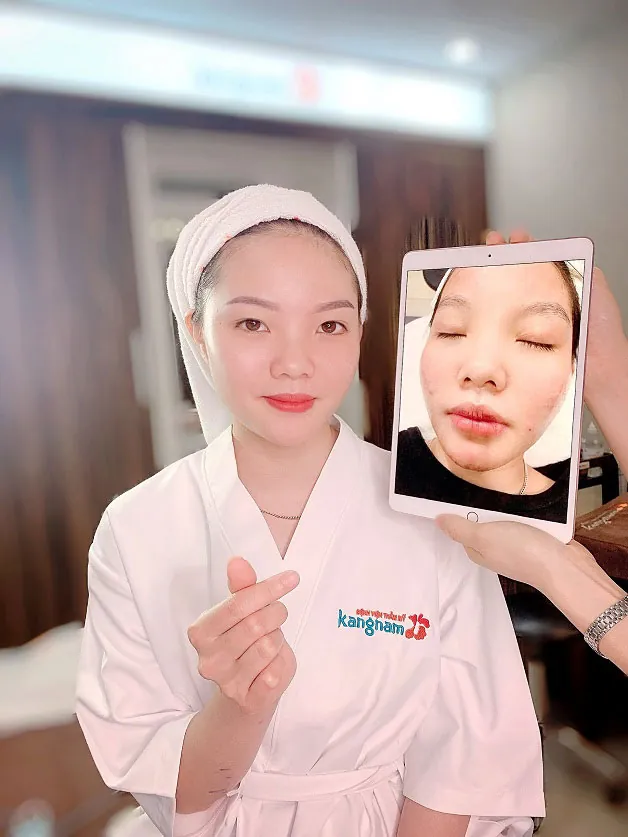 Quy trình xăm môi màu cam đào