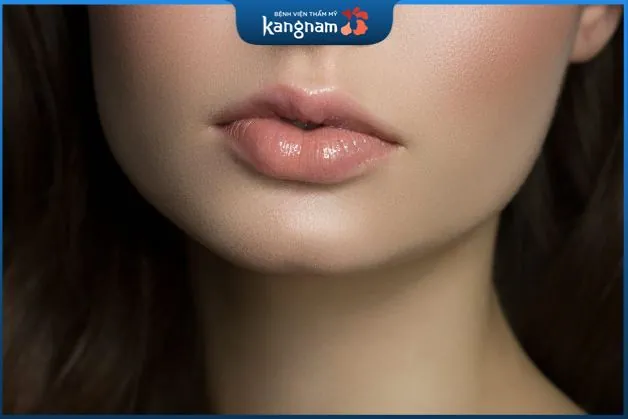 Tiêm filler môi trái tim sẽ hết sưng sau khoảng từ 5 - 7 ngày