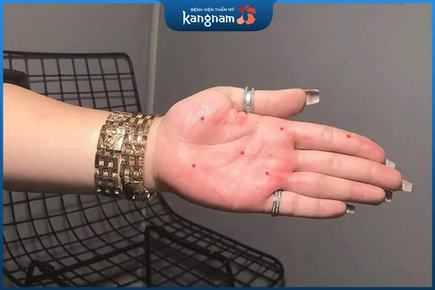 Hiện nay nhiều người lựa chọn cách xăm nốt ruồi phong thủy với mong muốn cải thiện vận số 