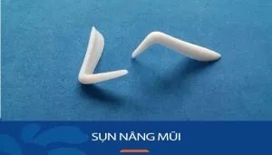 Đánh giá ưu nhược điểm của 9 loại sụn nâng mũi phổ biến