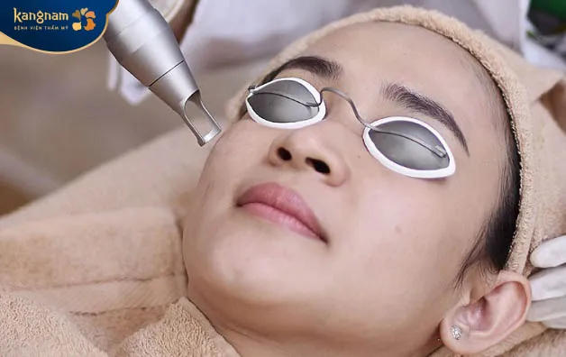 Điều trị mụn thịt khi đang mang thai bằng phương pháp laser an toàn tuyệt đối