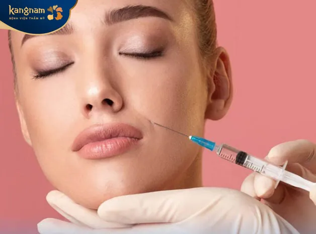 Tiêm filler rãnh cười có giá từ 4 - 14 triệu đồng/cc