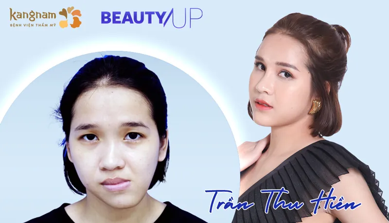 Kangnam Beauty Up - Thu Hiền