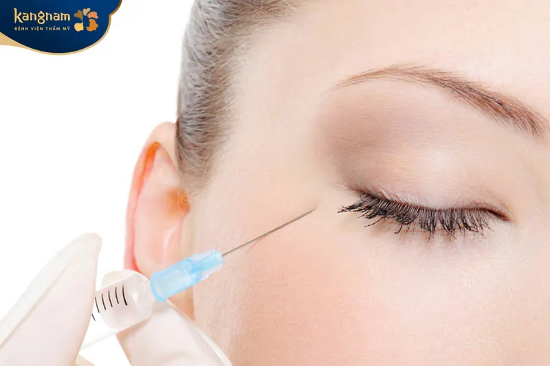 Tiêm filler trị thâm mắt giúp xóa tan quầng thâm, trẻ hóa đôi mắt.