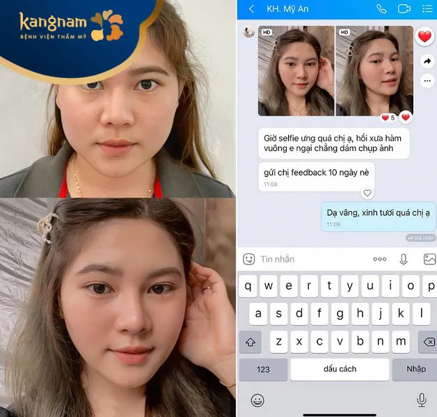 Khách hàng Mỹ An nhắn tin feedback với điều dưỡng của viện thẩm mỹ Kangnam Đà Nẵng