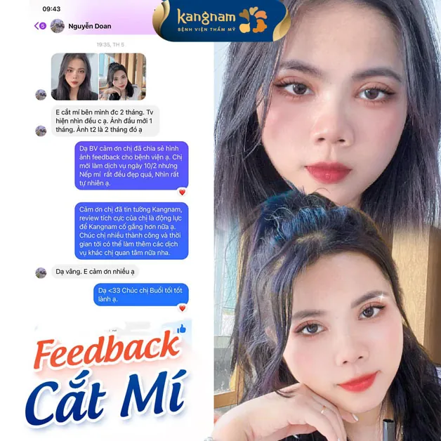Bạn Nguyễn Doan hài lòng với kết quả cặp mí mắt đều đẹp, sắc nét