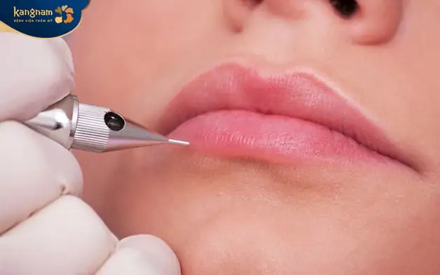 Môi sau khi khử thâm cần chăm sóc cẩn thận mới không thâm trở lại 