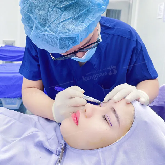 Quy trình cắt mí chuẩn y khoa