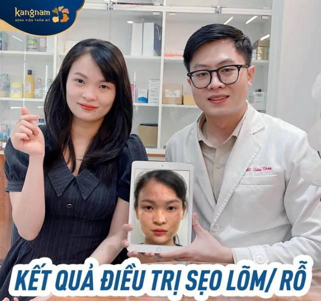 Khách hàng cảm thấy hài lòng sau khi trị sẹo tại Kangnam