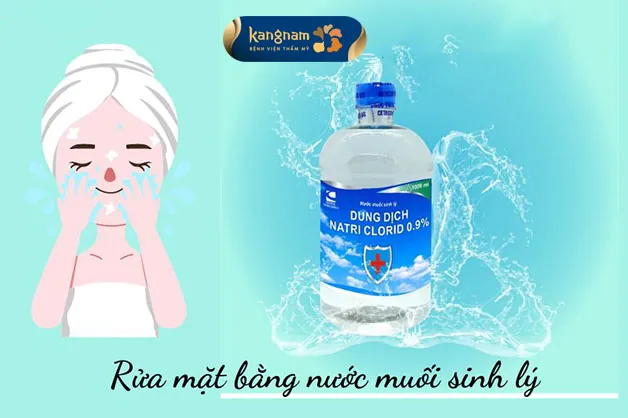 Những ngày đầu sau bóc tách sẹo rỗ chỉ nên vệ sinh bằng nước muối sinh lý 