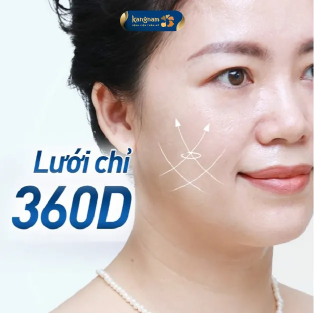 Các gai chỉ xoắn 360 độ có khả năng gia tăng lực kéo trên toàn bộ diện tích da, đem lại hiệu quả nâng cơ rõ rệt