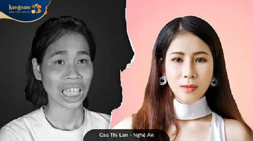 Sự thay đổi của Lan khiến mẹ ruột không nhận ra