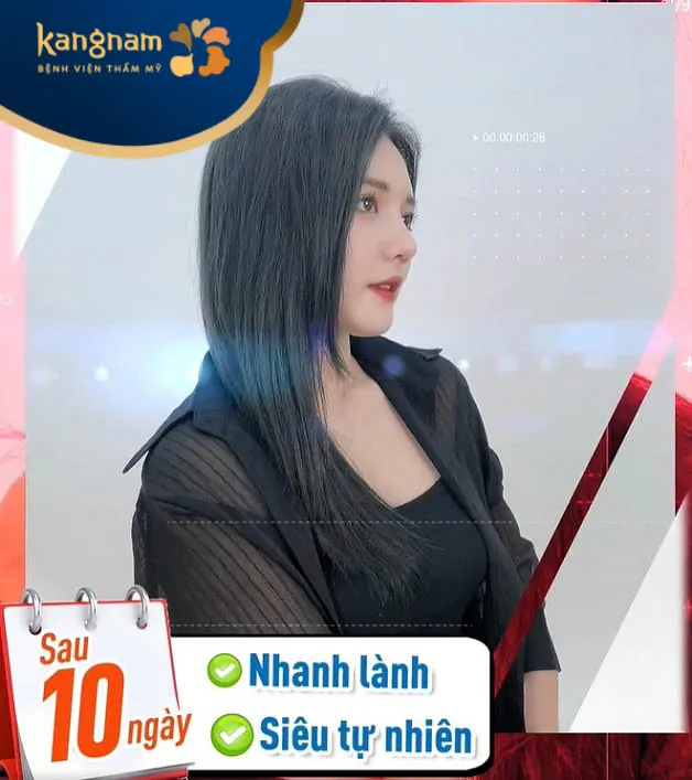 Trước và sau nâng mũi - hot girl 2k1 Thu Thảo tại Kangnam