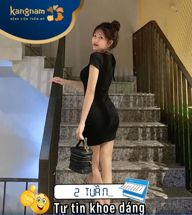 Sau 2 tuần hút mỡ, Thu Trang hài lòng với vóc dáng slim 
