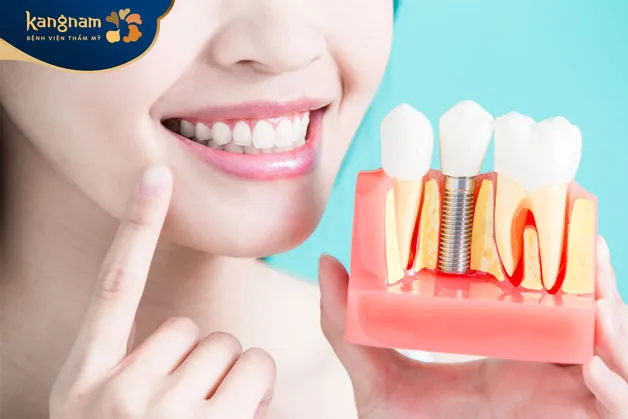 Những người đã mất một hoặc nhiều răng