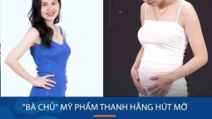 Thanh hằng hút mỡ tại kangnam