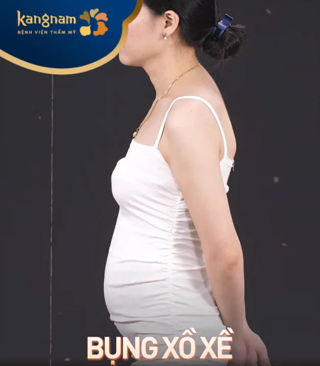 Bà chủ mỹ phẩm Thanh Hằng trước hút mỡ