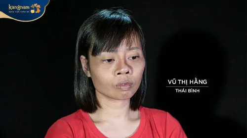 Sau 2 lần phẩu thuật hỏng, Vũ Thị Hằng đã không còn niềm tin vào thẩm mỹ