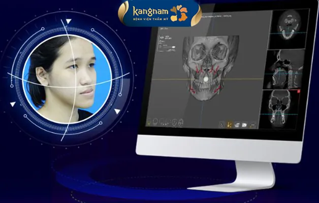 Bác sĩ sử dụng máy AI face để mô phỏng kết quả chỉnh hàm hô