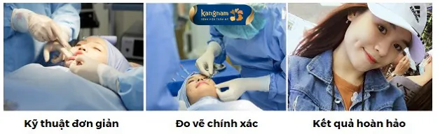 Phương pháp tạo hình má lúm 