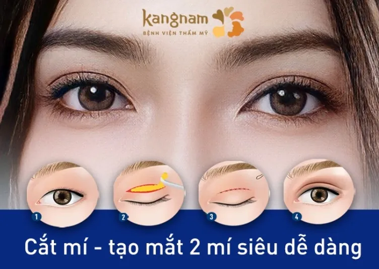 Phương pháp cắt mí tạo hình mắt 2 mí dễ dàng