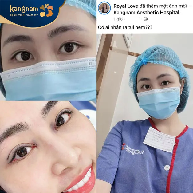 Sở hữu mắt 2 mí xinh xắn chỉ sau 30 phút