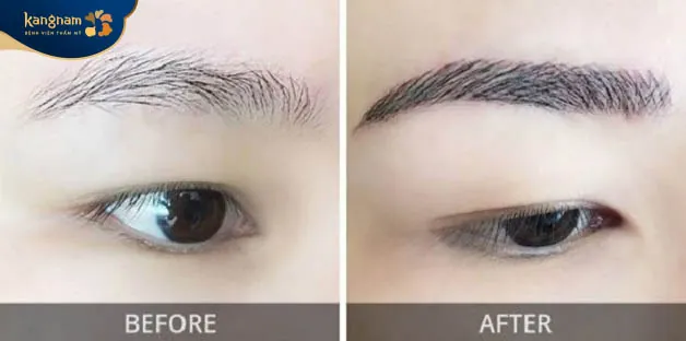 Phương pháp cấy lông mày là kỹ thuật tiên tiến, hiện đại