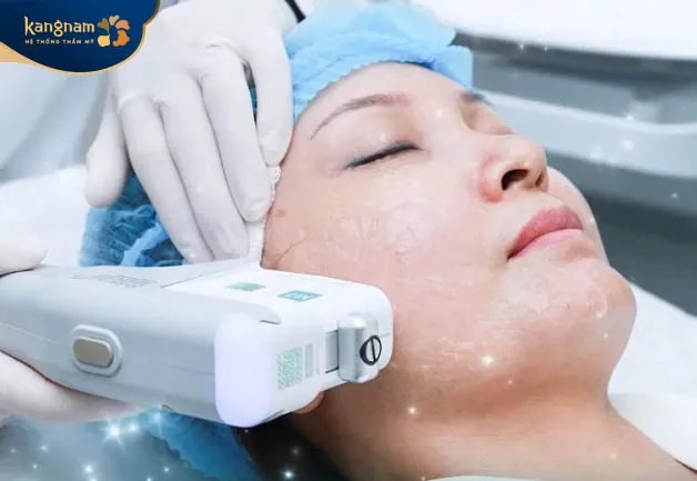 Quá trình điều trị sử dụng máy Hifu nhập khẩu trực tiếp từ Thụy Sĩ