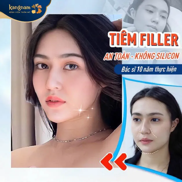 Tiêm filler tại Kangnam an toàn, không sử dụng silicon do bác sĩ da liễu thực hiện