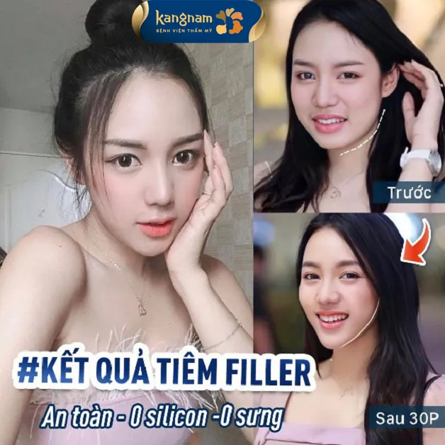 Gương mặt thanh tú, hài hòa, tràn đầy sức sống mà không cần phẫu thuật