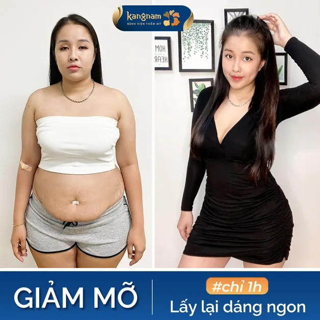 Giảm mỡ nhanh chóng, nhẹ nhàng