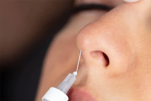 Chỉ Collagen có Chứa thành phần collagen đậm đặc ở lõi hoặc lớp vỏ chỉ