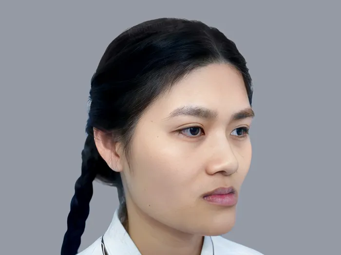 Phụ nữ mặt gãy