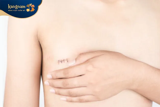 Chi phí trên chỉ mang tính chất tham khảo, có thể thay đổi tùy theo từng trường hợp cụ thể