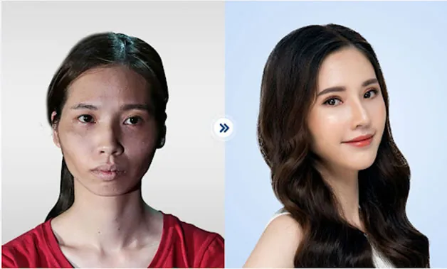 Thí sinh Hành trình Lột xác Phan Thị May lột xác thành hot girl sau khi chỉnh hàm