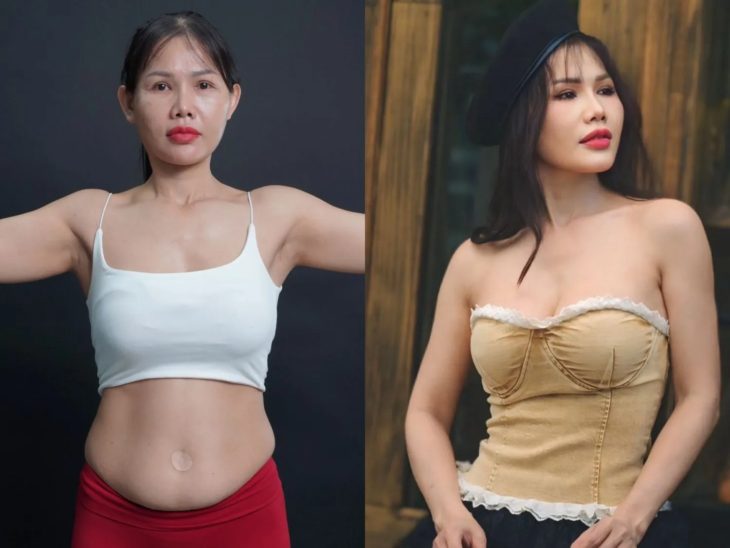 Chị Hoàng Diễm sau khi giảm mỡ thành công tại Kangnam