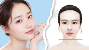 Gọt trán an toàn, nhanh chóng - Hạ trán tới 2cm, hết trán dô, tự tin ngoại hình mới